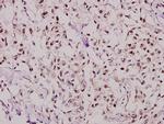 NFYB Antibody in Immunohistochemistry (Paraffin) (IHC (P))