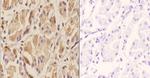 ETV6 Antibody in Immunohistochemistry (Paraffin) (IHC (P))