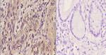 ETV6 Polyclonal Antibody