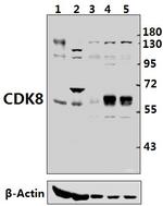 CDK8 Polyclonal Antibody