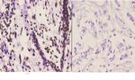 C/EBP delta/epsilon Polyclonal Antibody