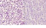 LMO4 Polyclonal Antibody