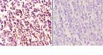 MEF2B Polyclonal Antibody