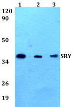 SRY Polyclonal Antibody