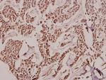 TCOF1 Polyclonal Antibody
