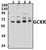 GCKR Polyclonal Antibody