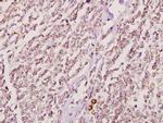 GK2 Polyclonal Antibody