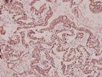BRMS1 Polyclonal Antibody