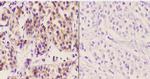 DCP1A Antibody in Immunohistochemistry (Paraffin) (IHC (P))