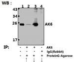 AK6 Antibody in Immunoprecipitation (IP)