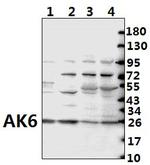 AK6 Polyclonal Antibody