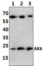 AK6 Antibody in Western Blot (WB)