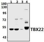 TBX22 Polyclonal Antibody