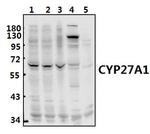 CYP27A1 Antibody in Western Blot (WB)