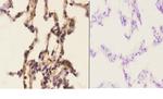 APC6 Antibody in Immunohistochemistry (Paraffin) (IHC (P))