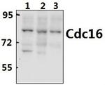APC6 Antibody in Western Blot (WB)