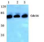 APC6 Antibody in Western Blot (WB)
