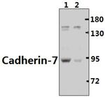 CDH7 Antibody in Western Blot (WB)