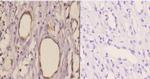 TANK Polyclonal Antibody