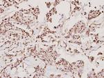 TMPRSS3 Polyclonal Antibody