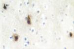 MVK Polyclonal Antibody