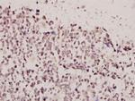 FOXE3 Polyclonal Antibody