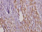 MKP4 Polyclonal Antibody