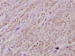 COL4A2 Polyclonal Antibody