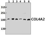 COL4A2 Antibody in Western Blot (WB)