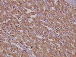 MSH3 Polyclonal Antibody