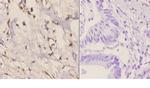 RAD51C Polyclonal Antibody