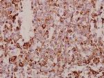 TSPAN8 Antibody in Immunohistochemistry (Paraffin) (IHC (P))