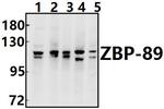 ZNF148 Antibody in Western Blot (WB)