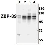 ZNF148 Antibody in Western Blot (WB)
