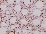 MUTYH Polyclonal Antibody