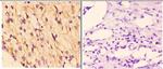 RAD51B Polyclonal Antibody