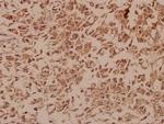 NAB2 Polyclonal Antibody
