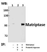 ST14 Antibody in Immunoprecipitation (IP)