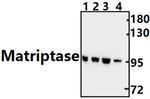 ST14 Polyclonal Antibody