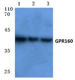 GPR160 Polyclonal Antibody