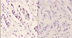 TNFAIP6 Polyclonal Antibody