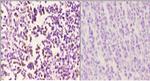 CAF1 p60 Polyclonal Antibody