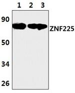 ZNF225 Polyclonal Antibody