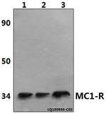 MC1R Polyclonal Antibody