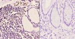 IP6K2 Polyclonal Antibody