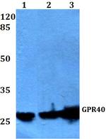 GPR40 Polyclonal Antibody