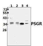 PSGR Polyclonal Antibody