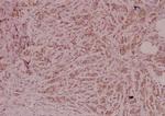 PEDF Polyclonal Antibody