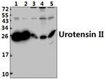 UTS2 Polyclonal Antibody