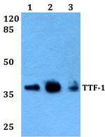 Nkx2.1 Polyclonal Antibody